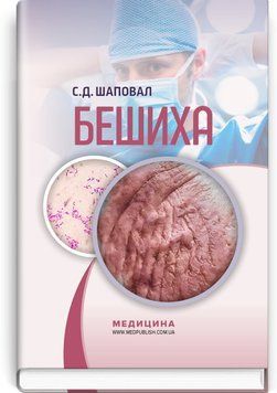 Бешиха. С.Д. Шаповал. 9786178347451 фото